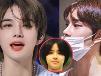 NCT Jungwoo Dituduh Jalani Operasi Hidung Setelah Foto Pra-Debut Idol Muncul Kembali 17